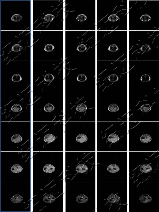 低場核磁共振技術在造影劑與動物成像中的應用